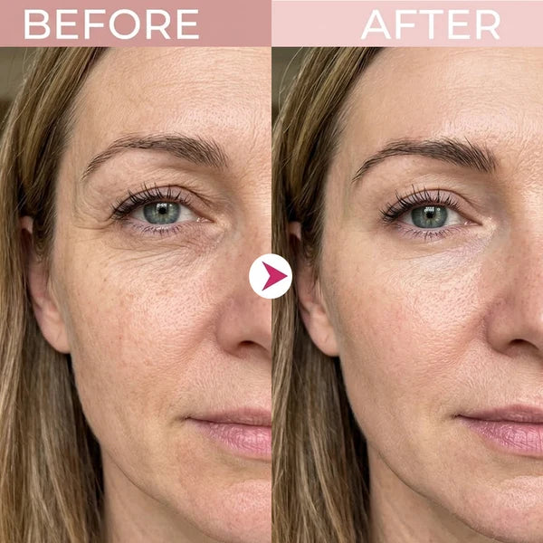 P7 Eye Renewal Crème
