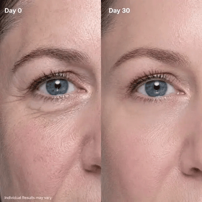 P7 Eye Renewal Crème